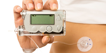 CGM is a great way to better monitor your blood sugar